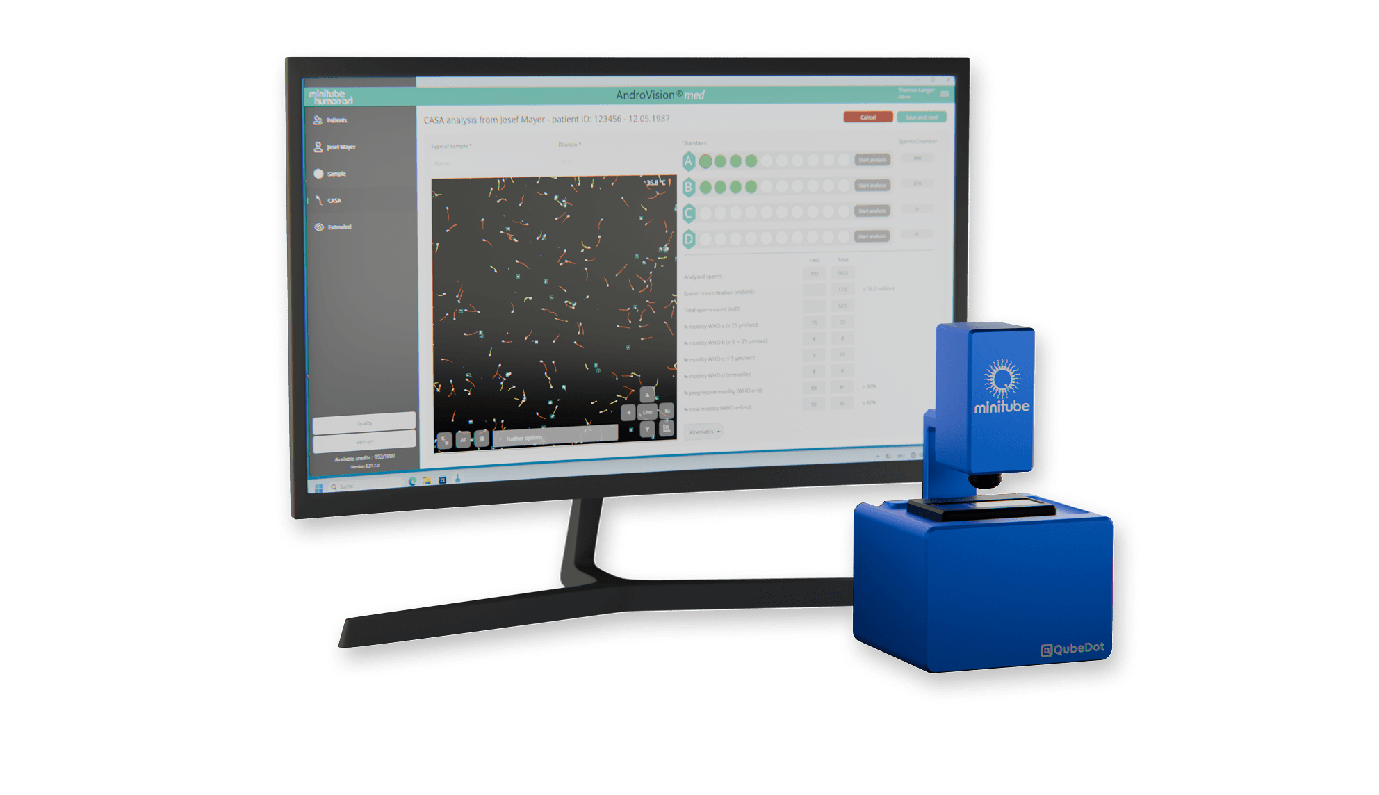 The AndroVision med CASA software interface displayed on a computer screen next to the blue MiniQube digital microscope, isolated on a white background.